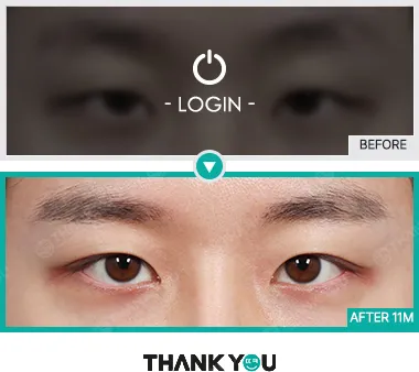 Before & After