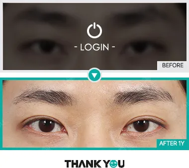 Before & After