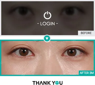 Before & After