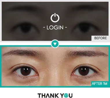 Before & After