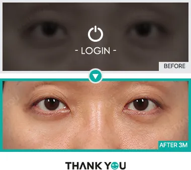 Before & After