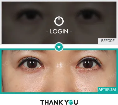 Before & After
