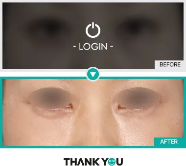 Before & After
