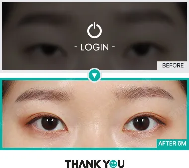 Before & After
