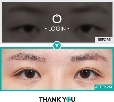 Before & After