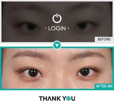 Before & After