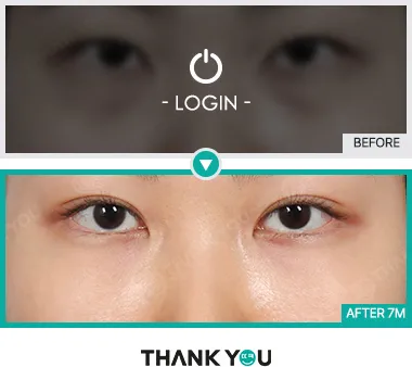 Before & After