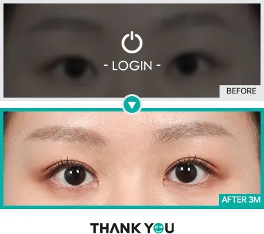 Before & After