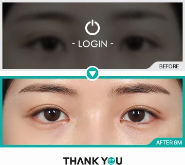 Before & After
