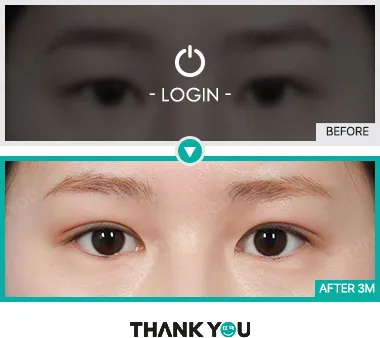 Before & After