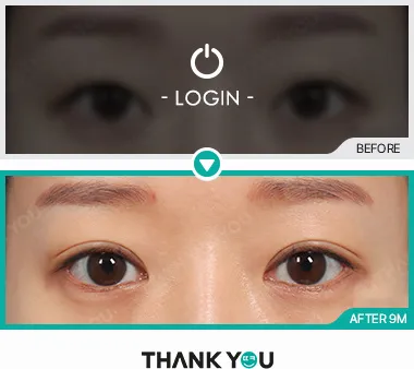 Before & After