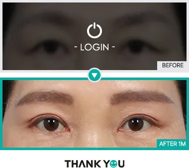 Before & After