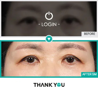 Before & After