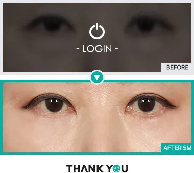 Before & After