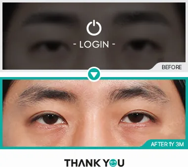 Before & After