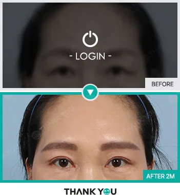 Before & After
