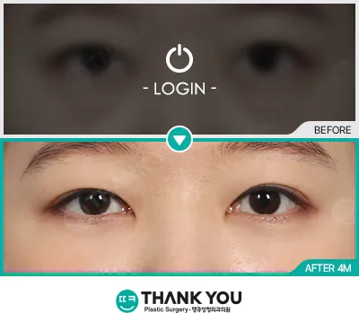 Before & After