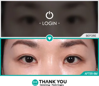 Before & After
