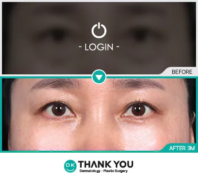 Before & After