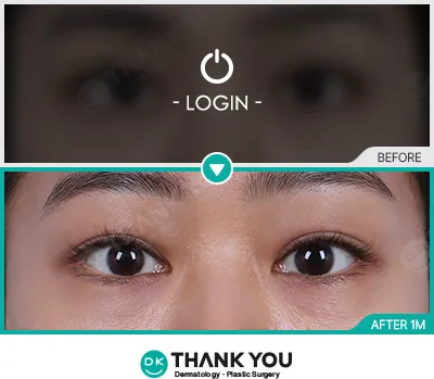 Before & After