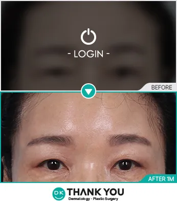 Before & After