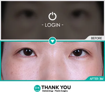 Before & After