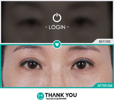 Before & After