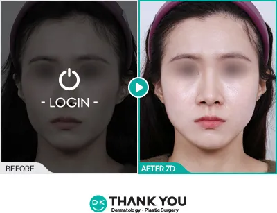Before & After