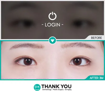Before & After