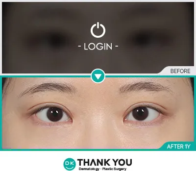 Before & After