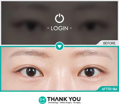 Before & After