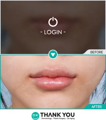 Before & After