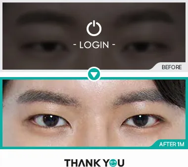 Before & After