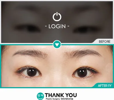 Before & After