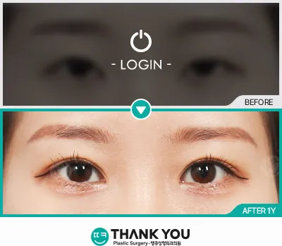 Before & After