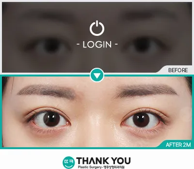 Before & After