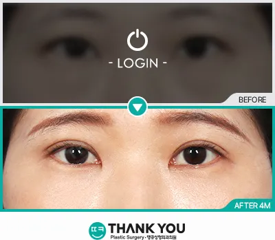 Before & After