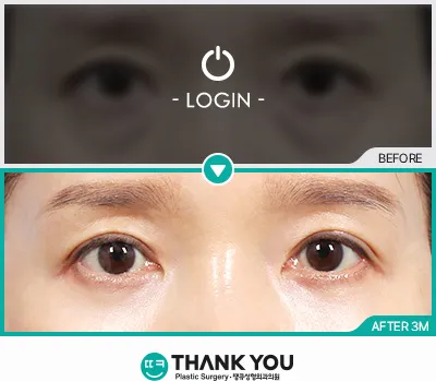 Before & After