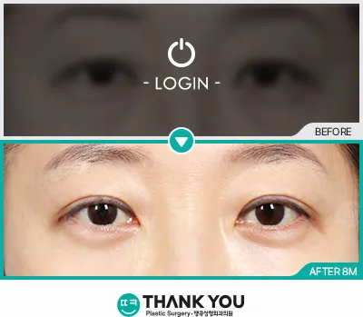 Before & After