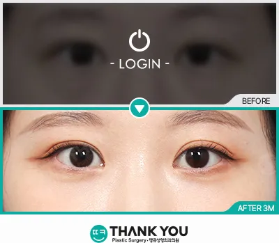 Before & After