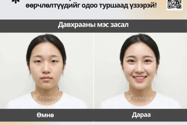 💎 Солонгосын гоо сайхны мэс заслын эмнэлгийн бүх мэдээлэл энд!