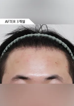 After