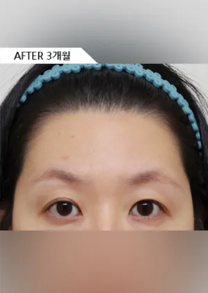 After