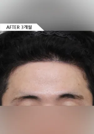 After