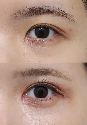 After