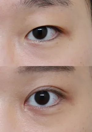 After