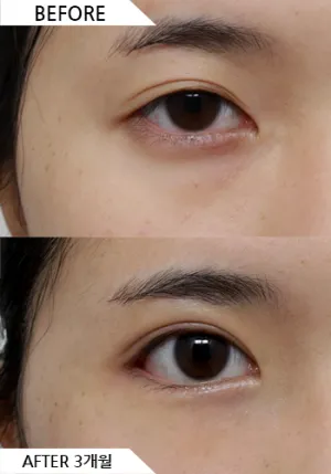 Before