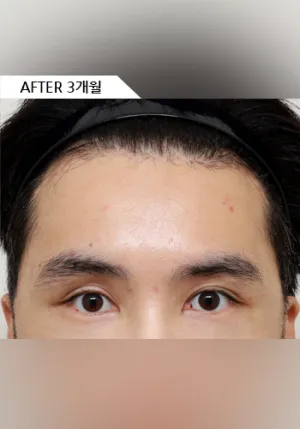 After