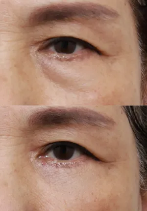 After