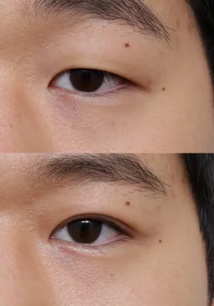 After